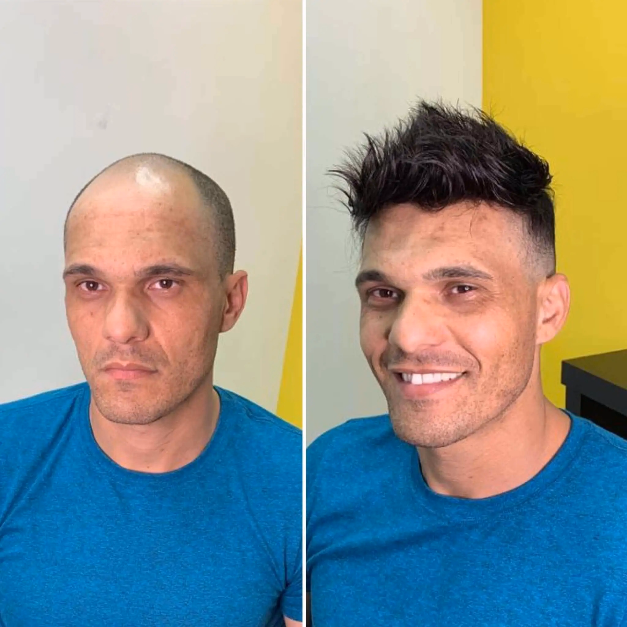 Manutenção de prótese capilar masculina técnica Alaíde Francisca